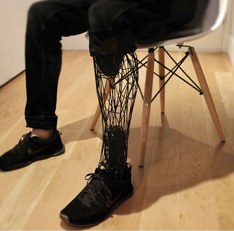 EXO 3D Printed Prosthetic Limbs by William Root Homeli