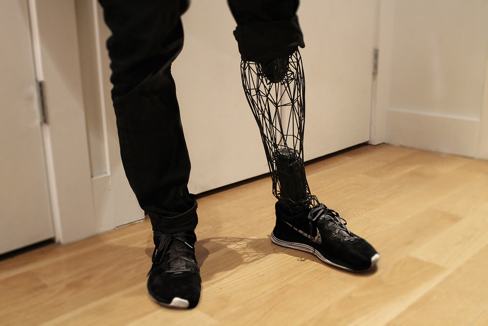 Standing with an Exo Prosthetic Lower Leg