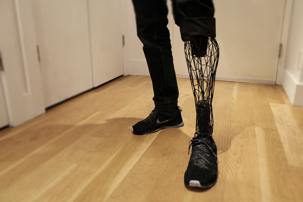 EXO 3D Printed Prosthetic Limbs by William Root